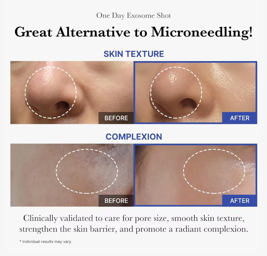 Medicube One Day Exosome Shot 2000 (30mL)