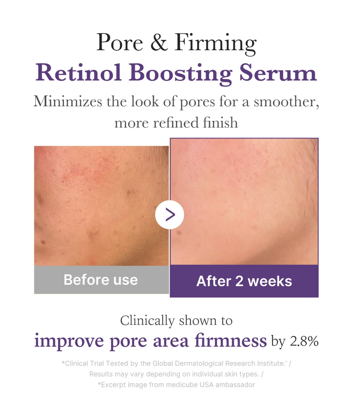 Medicube Retinol NMN Boosting Serum (30mL)
